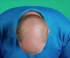 Hair Grow Max 2x1 a 1.261 CZK