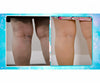 Veins Gone 2x1 a 39,99€